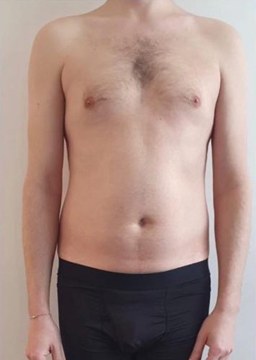 Before image alt